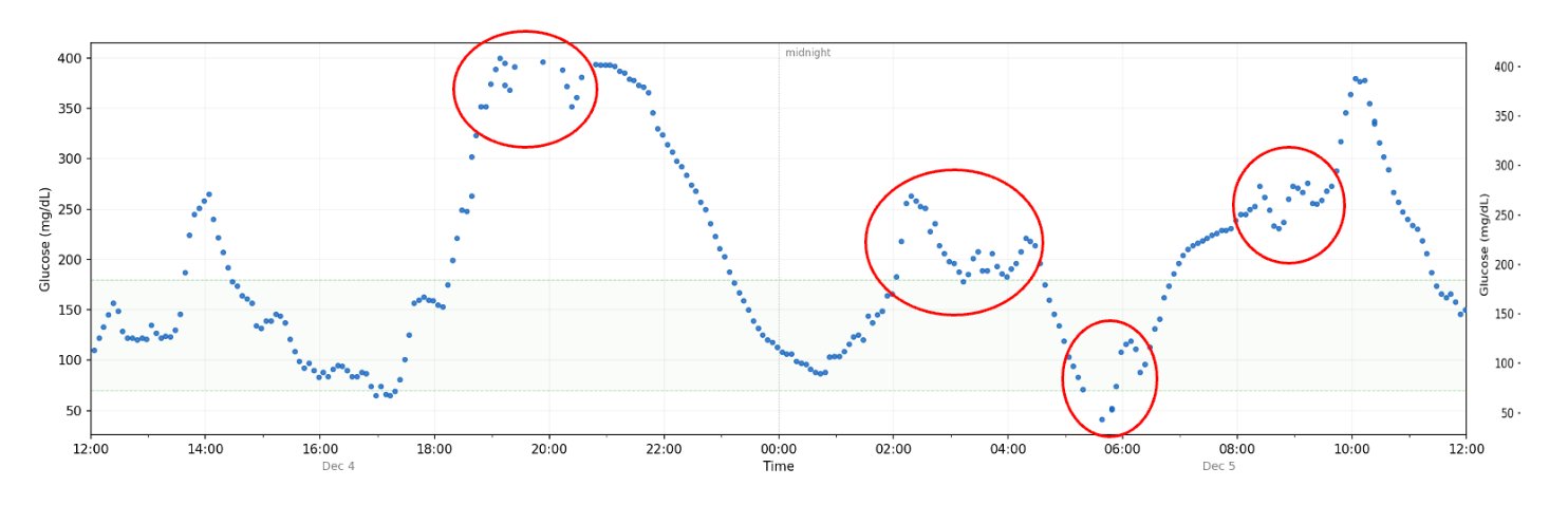 Raw CGM trace showing zig-zagging noise clusters from Jane Doe's sensor